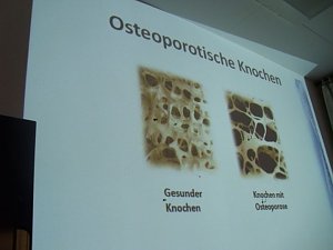 Wissenswertes zur Knochengesundheit
