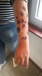 Jugendrotkreuz Sondershausen misst sich bei seinem Jahresh&ouml;hepunkt in Immenrode !