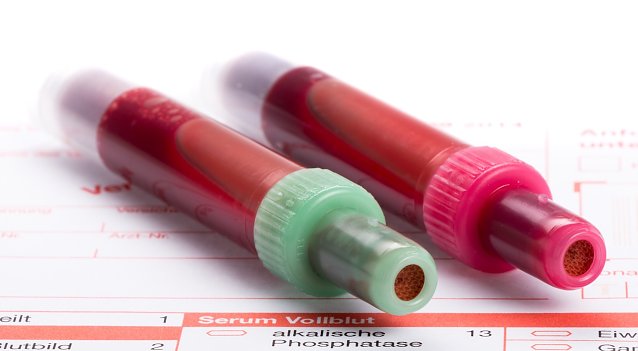 Bild: sepsis