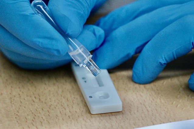 Bild: Covid-19 Antigentest (Schnelltest)