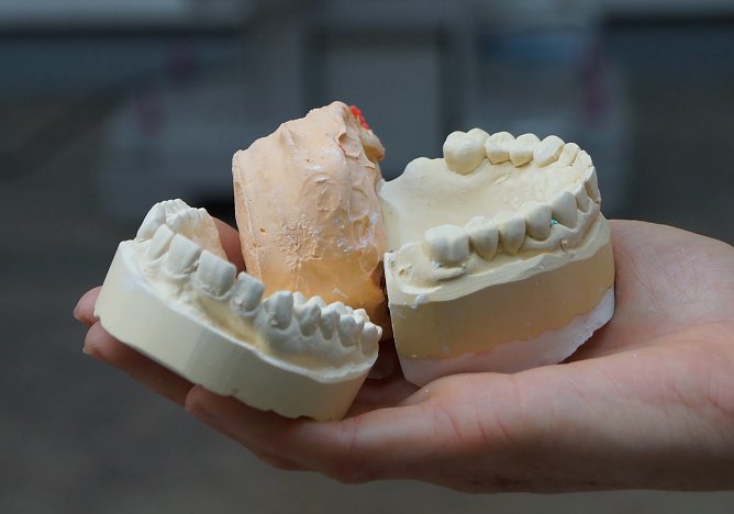 Eine Befragung soll kl&auml;ren wie Gipsabf&auml;lle aus Unternehmen, z.B. Formgipse aus der Dentalindustrie, zuk&uuml;nftig recycelt werden k&ouml;nnen (Foto: Katrin Schmidt)