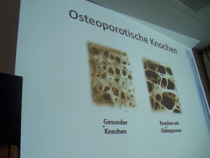 Wissenswertes zur Knochengesundheit