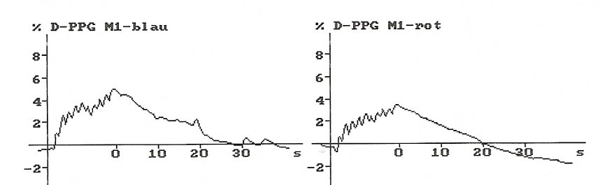 Gesundheitstag in der Therme wieder gut besucht